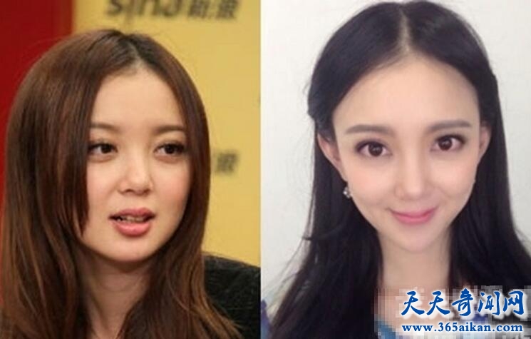 汪小敏整容前后对比照片