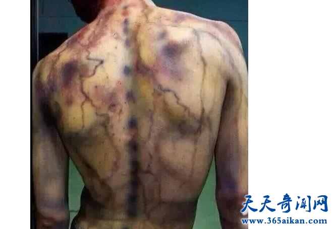 被雷劈了七次还不死的人！1.jpg