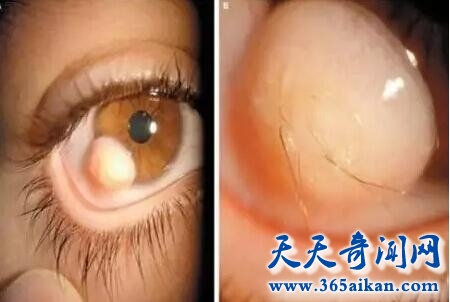 毛毛眼1.jpg