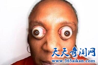 最凸瞳孔1.jpg