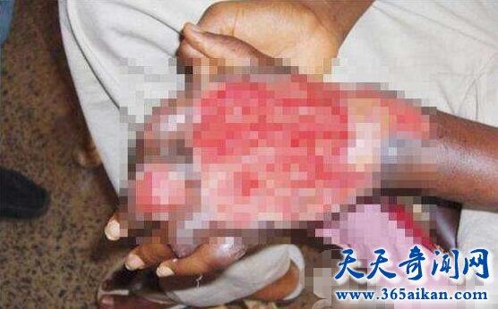 食肉菌1.jpg