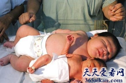 澳大利亚女子产下18公斤巨婴，打破世界纪录