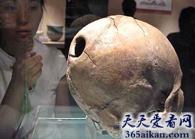 中国5000年前就有开颅手术.jpg