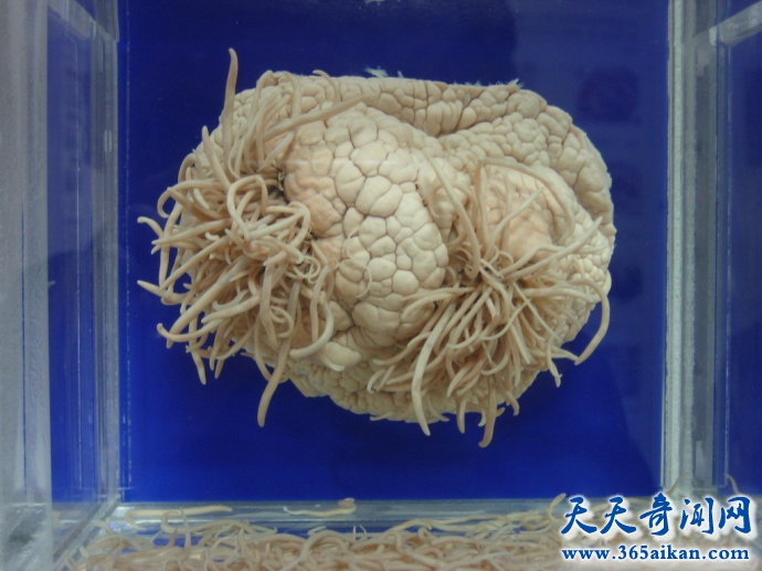世界上最奇特的博物馆，日本寄生虫博物馆带您走进寄生虫的世界！