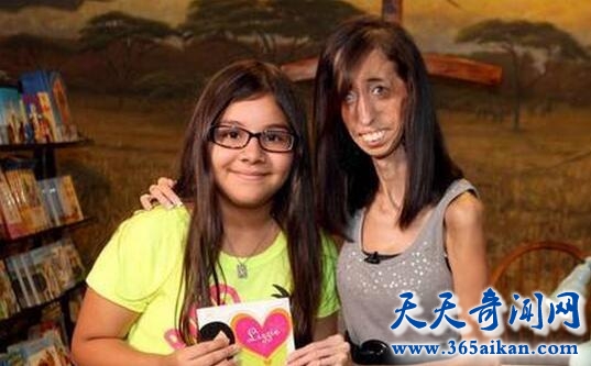 Lizzie Velasquez2.jpg