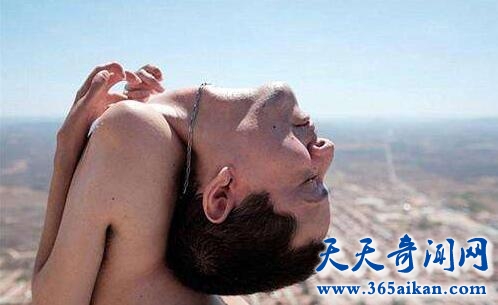 巴西男子头部畸形生长！探秘：头朝下的生活是怎样的？