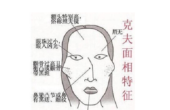 女人克夫面相是怎么样的？