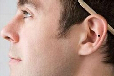 身上长痣图解：耳根和耳内有痣吉凶如何？