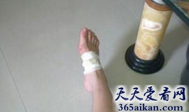 梦见走路拐了脚是怎么回事?梦见走路拐了脚是什么含义?