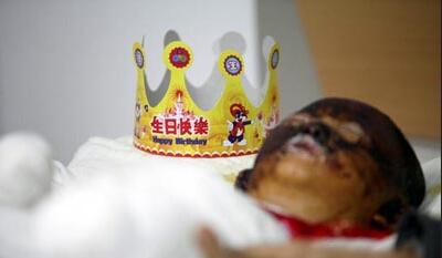 梦见女儿被火烧头是吉兆还是凶兆？.jpg