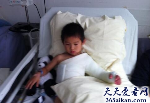 梦见胳膊断了.jpg