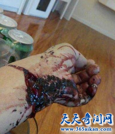 割腕.jpg