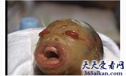 女子产下外星人5.jpg