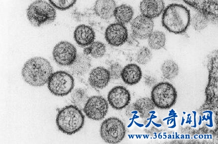 汉坦病毒1.jpg