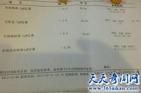 巨细胞病毒 5.jpg