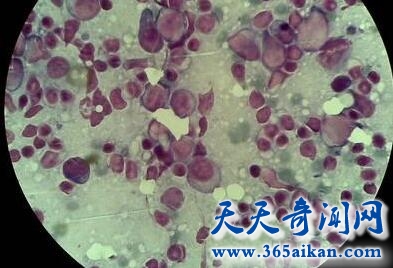 EB病毒1.jpg