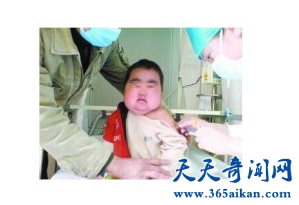 巨细胞病毒2.jpg