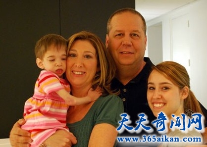 人类史上最奇特的病症，探寻不老女婴能使人类长生不老吗？