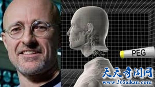 科学幻想，头颅移植到底能够成功吗？