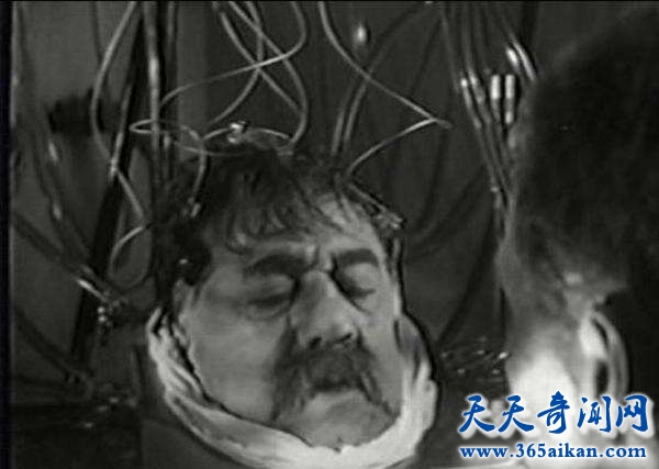 科学幻想，头颅移植到底能够成功吗？