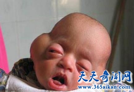 揭秘地球上各种神奇的返祖现象，返祖现象反应远古人类的特征！
