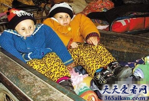 未老先衰男童之谜.jpg